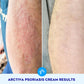 Steroid-Free Psoriasis Cream with Salicylic Acid enhanced with HYDROSURF Glycolipid Technology