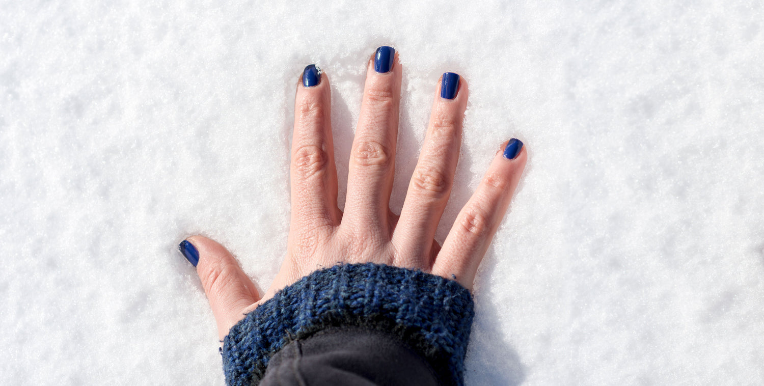 Winter Eczema 5 Tips to Combat Your Eczema Every Winter
